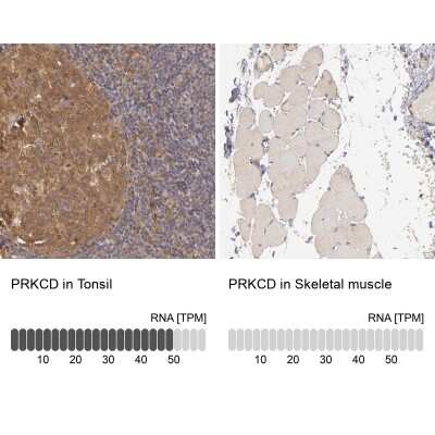 <b>Orthogonal Strategies Validation. </b>Immunohistochemistry-Paraffin: PKC delta Antibody [NBP1-90957] - Analysis in human tonsil and skeletal muscle tissues. Corresponding PKC delta RNA-seq data are presented for the same tissues.