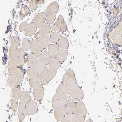 Immunohistochemistry-Paraffin: PKC delta Antibody [NBP1-90957] - Staining of human skeletal muscle shows only very weak cytoplasmic positivity in myocytes.