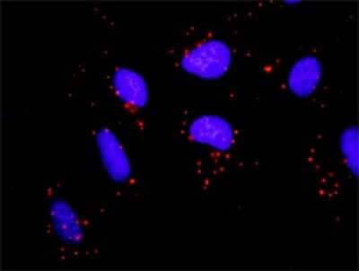 Proximity Ligation Assay: PKC delta Antibody [H00005580-D01P] - Analysis of protein-protein interactions between PRKCD and FYN. HeLa cells were stained with anti-PRKCD rabbit purified polyclonal 1:1200 and anti-FYN mouse monoclonal antibody 1:50. Each red dot represents the detection of protein-protein interaction complex, and nuclei were counterstained with DAPI (blue).