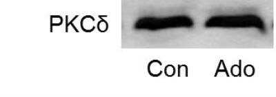 Western Blot: PKC delta Antibody [H00005580-D01P] - Human breast cancer MCF-7 cells were treated with control (Con) or Adenosine (Ado) and the expression of total PKCdelta was detected. Image from verified customer review.