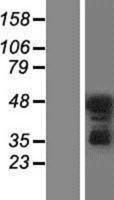 Western Blot: PKC delta Overexpression Lysate (Adult Normal) [NBP2-10423] Left-Empty vector transfected control cell lysate (HEK293 cell lysate); Right -Over-expression Lysate for PKC delta.