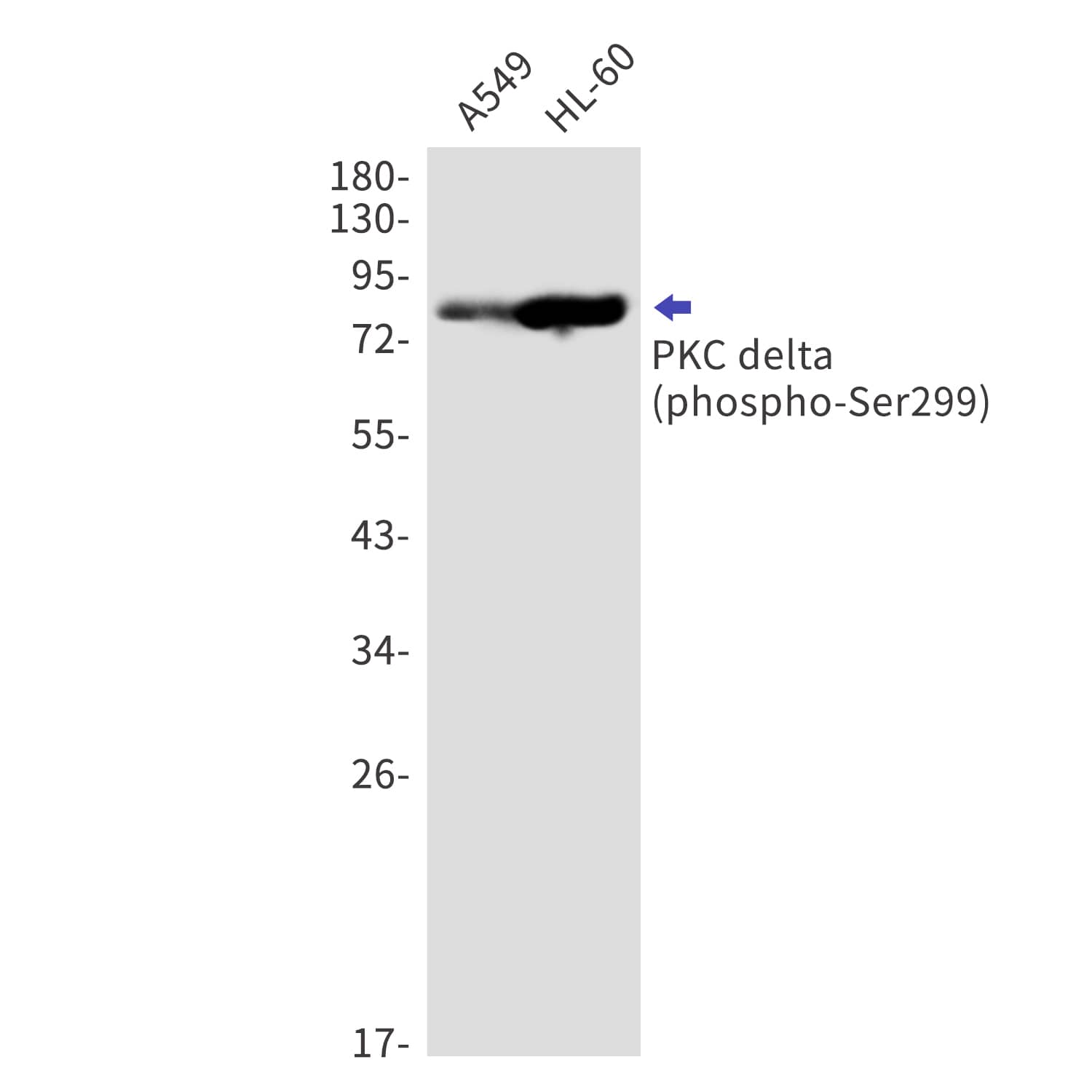 Western Blot: PKC delta [p Ser299] Antibody (S06-4A5) [NBP3-19827] - Western blot detection of phospho-PKC delta (Ser299) in A549, HL-60 cell lysates using NBP3-19827 (1:1000 diluted). Predicted band size: 78kDa. Observed band size: 78kDa.