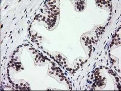 Immunohistochemistry-Paraffin: PKC epsilon Antibody (4G8) [NBP2-03620] - Staining of paraffin-embedded Human prostate tissue using anti-PKC epsilon mouse monoclonal antibody.