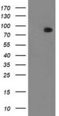 Western Blot: PKC epsilon Antibody (4G8) [NBP2-03620] - HEK293T cells were transfected with the pCMV6-ENTRY control (Left lane) or pCMV6-ENTRY PKC epsilon (Right lane) cDNA for 48 hrs and lysed. Equivalent amounts of cell lysates (5 ug per lane) were separated by SDS-PAGE and immunoblotted with anti-PKC epsilon.