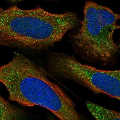 Immunocytochemistry/Immunofluorescence: PKC epsilon Antibody [NBP2-54970] - Staining of human cell line U-2 OS shows localization to vesicles.