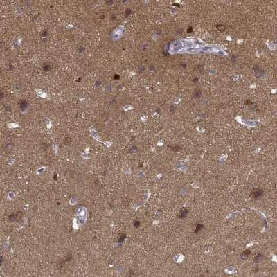 Immunohistochemistry-Paraffin: PKC epsilon Antibody [NBP2-38531] - Staining of human cerebral cortex shows moderate to strong cytoplasmic positivity in neuropil and neuronal cells.