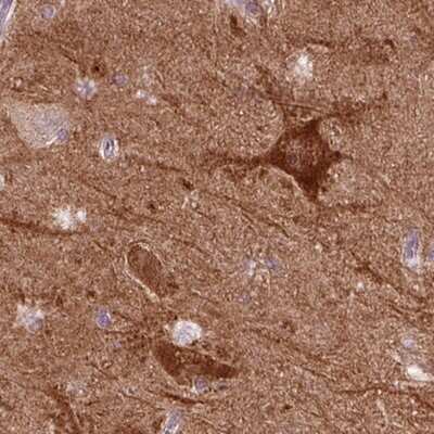 Immunohistochemistry-Paraffin: PKC epsilon Antibody [NBP2-38531] - Staining of human hippocampus shows strong cytoplasmic positivity in neuronal cells.