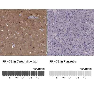 <b>Orthogonal Strategies Validation. </b>Immunohistochemistry-Paraffin: PKC epsilon Antibody [NBP2-38531] - Staining in human cerebral cortex and pancreas tissues using anti-PRKCE antibody. Corresponding PRKCE RNA-seq data are presented for the same tissues.