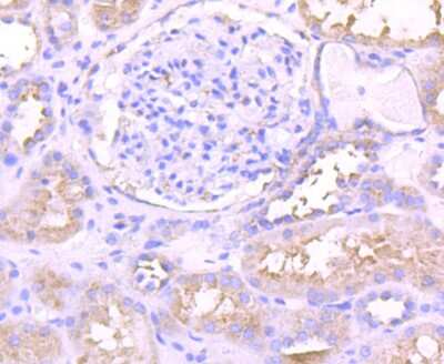 Immunohistochemistry-Paraffin: PKC epsilon Antibody (JA38-21) [NBP2-67063] - Analysis of paraffin-embedded human kidney tissue using anti-PKC epsilon antibody. Counter stained with hematoxylin.