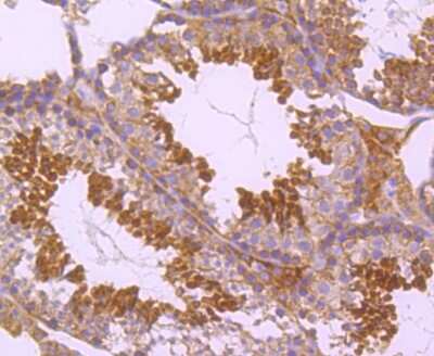 Immunohistochemistry-Paraffin: PKC epsilon Antibody (JA38-21) [NBP2-67063] - Analysis of paraffin-embedded mouse testis tissue using anti-PKC epsilon antibody. Counter stained with hematoxylin.