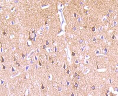 Immunohistochemistry-Paraffin: PKC epsilon Antibody (JA38-21) [NBP2-67063] - Analysis of paraffin-embedded rat brain tissue using anti-PKC epsilon antibody. Counter stained with hematoxylin.