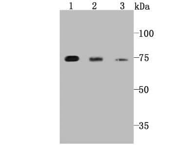 Western Blot: PKC epsilon Antibody (JA38-21) [NBP2-67063] - Analysis of PKC epsilon on different cell lysates using anti-PKC epsilon antibody at 1/1,000 dilution. Positive control:Lane1: Jurkat Lane2: MCF-7 Lane3: HT-29