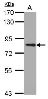 Western Blot: PKC epsilon Antibody [NBP2-19848] - Sample (30 ug of whole cell lysate) A: A431 7. 5% SDS PAGE gel, diluted at 1:1000.