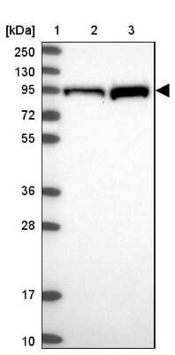 Western Blot: PKC epsilon Antibody [NBP2-38531] - Lane 1: Marker  [kDa] 250, 130, 95, 72, 55, 36, 28, 17, 10.  Lane 2: Human cell line RT-4.  Lane 3: Human cell line U-251MG