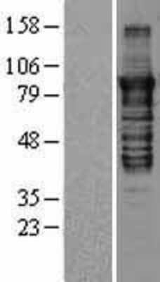 Western Blot PKC epsilon Overexpression Lysate