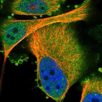 Immunocytochemistry/Immunofluorescence: PKC eta Antibody [NBP1-80899] - Immunofluorescent staining of human cell line U-251 MG shows localization to plasma membrane & cytosol.