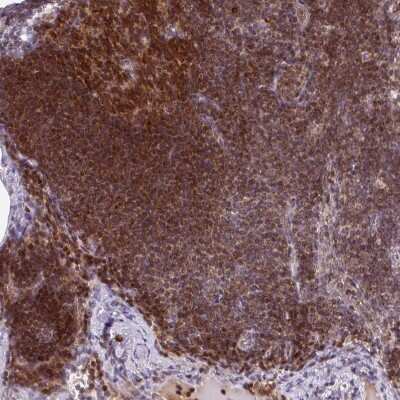 Immunohistochemistry-Paraffin: PKC eta Antibody [NBP2-38711] - Staining of human lymphoid tissues shows strong cytoplasmic positivity in germinal and non-germinal cells.