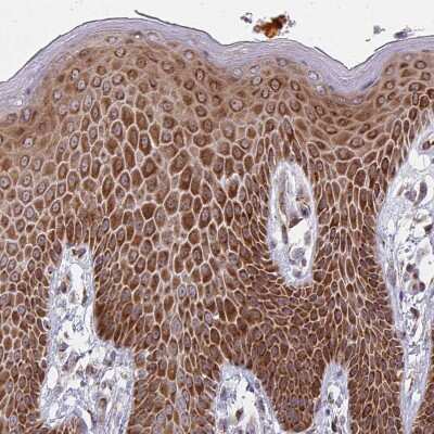 Immunohistochemistry-Paraffin: PKC eta Antibody [NBP2-38711] - Staining of human skin shows moderate cytoplasmic positivity in epidermis.