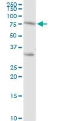 Western Blot: PKC eta Antibody [H00005583-D01P] - Analysis of PRKCH expression in human kidney.