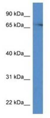 Western Blot: PKC eta Antibody [NBP1-74117] - Mouse Brain Lysate 1ug/ml  Gel Concentration 12%