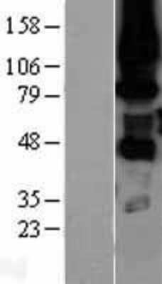 Western Blot: PKC eta Overexpression Lysate (Adult Normal) [NBL1-14776] Left-Empty vector transfected control cell lysate (HEK293 cell lysate); Right -Over-expression Lysate for PKC eta.