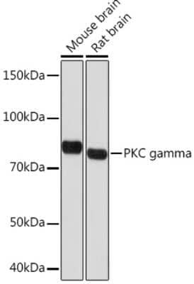 Western Blot: PKC gamma Antibody (5F2X3) [NBP3-16611] - Western blot analysis of extracts of various cell lines, using PKC gamma Rabbit mAb (NBP3-16611) at 1:1000 dilution. Secondary antibody: HRP Goat Anti-Rabbit IgG (H+L) at 1:10000 dilution. Lysates/proteins: 25ug per lane. Blocking buffer: 3% nonfat dry milk in TBST. Detection: ECL Basic Kit. Exposure time: 10s.