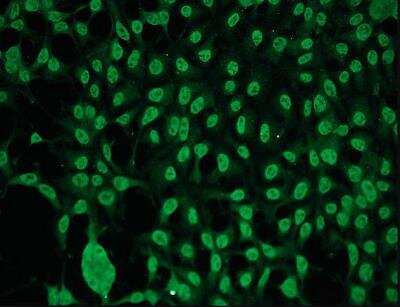 Immunocytochemistry/Immunofluorescence: PKC gamma Antibody (A12-H) [NBP1-30124] - PKC-gamma expression in HEK293 cells.