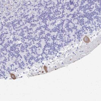 Immunohistochemistry: PKC gamma Antibody [NBP2-38569] - Staining of human cerebellum shows moderate cytoplasmic positivity in Purkinje cells.