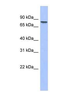 Western Blot: PKC gamma Antibody [NBP1-58916] - Human Placenta lysate, concentration 0.2-1 ug/ml.