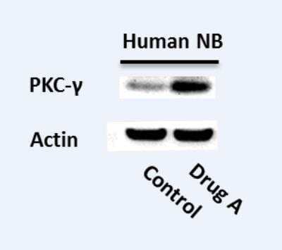 Western Blot: PKC gamma Antibody [NBP1-58916] - Human neuroblastoma cells untreated or treated with various drugs. Image from verified customer review.