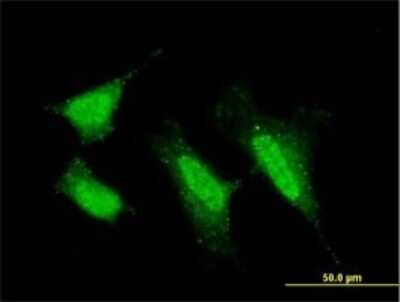 Immunocytochemistry/Immunofluorescence: PKC iota Antibody (1G11) [H00005584-M01] - Analysis of monoclonal antibody to PRKCI on HeLa cell . Antibody concentration 10 ug/ml.