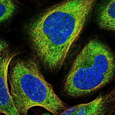 Immunocytochemistry/Immunofluorescence: PKC iota Antibody [NBP2-58629] - Staining of human cell line U-2 OS shows localization to cytosol, microtubules & cytokinetic bridge. Antibody staining is shown in green.