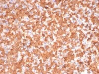 Immunohistochemistry-Paraffin: PKC iota Antibody (PRKCI/4911) [NBP3-13752] - Formalin-fixed, paraffin-embedded dog liver stained with PKC iota antibody (PRKCI/4911). HIER: Tris/EDTA, pH9.0, 45min. HRP-polymer, 30min. DAB, 5min.