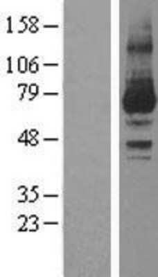 Western Blot: PKC iota Overexpression Lysate (Adult Normal) [NBL1-14777] Left-Empty vector transfected control cell lysate (HEK293 cell lysate); Right -Over-expression Lysate for PKC iota.