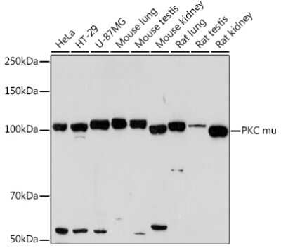 Western Blot: PKC mu Antibody (2A5U1) [NBP3-16130] - Western blot analysis of extracts of various cell lines, using PKC mu Rabbit mAb (NBP3-16130) at 1:1000 dilution. Secondary antibody: HRP Goat Anti-Rabbit IgG (H+L) at 1:10000 dilution. Lysates/proteins: 25ug per lane. Blocking buffer: 3% nonfat dry milk in TBST. Detection: ECL Enhanced Kit. Exposure time: 3min.