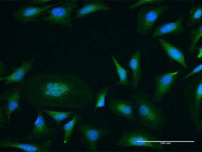 Immunocytochemistry/Immunofluorescence: PKC mu Antibody [H00005587-B01P] - Analysis of purified antibody to PRKD1 on HeLa cell. (antibody concentration 10 ug/ml)