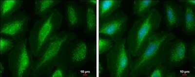 <b>Independent Antibodies Validation. </b>Immunocytochemistry/Immunofluorescence: PKC mu Antibody [NBP3-13292] - PKC mu antibody detects PKC mu protein at cytoplasm by immunofluorescent analysis. Sample: HeLa cells were fixed in ice-cold MeOH for 5 min. Green: PKC mu protein stained by PKC mu antibody (NBP3-13292) diluted at 1:500. Blue: Hoechst 33342 staining. Scale bar = 10 um.