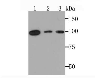Western Blot: PKC mu Antibody (JM30-17) [NBP2-67066] - Analysis of PKC mu on different lysates using anti-PKC mu antibody at 1/1,000 dilution. Positive control: Lane1: Hela Lane2: Mouse kidney Lane3: PC12