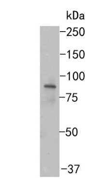 Western Blot: PKC mu Antibody (JM30-17) [NBP2-67066] - Western blot analysis of PKC mu on PC3 lysate using anti-PKC mu antibody at 1/500 dilution.