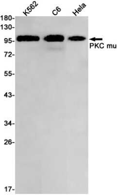 Western Blot: PKC mu Antibody (S05-4J5) [NBP3-14964] - Western blot detection of PKC mu in K562, C6, Hela cell lysates using PKC mu Rabbit mAb (1:1000 diluted). Predicted band size: 102kDa. Observed band size: 102kDa.