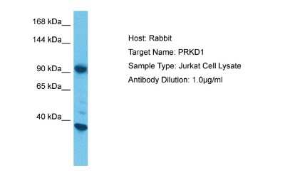 Western Blot: PKC mu Antibody [NBP2-88057] - Host: Rabbit. Target Name: PRKD1. Sample Tissue: Human Jurkat Whole Cell lysates. Antibody Dilution: 1ug/ml