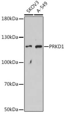 Western Blot: PKC mu Antibody [NBP2-94000] - Analysis of extracts of various cell lines, using PKC mu . Exposure time: 90s.