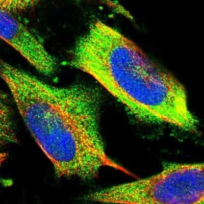 Immunocytochemistry/ Immunofluorescence PKC zeta Antibody