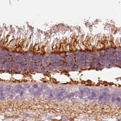 Immunohistochemistry-Paraffin PKC zeta Antibody