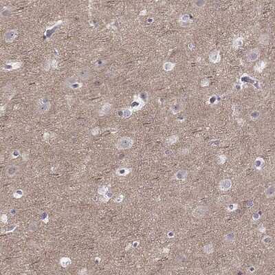 Immunohistochemistry-Paraffin: PKC zeta Antibody [NBP1-87270] - Staining of human cerebral cortex shows moderate positivity in neuropil.