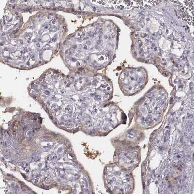 Immunohistochemistry-Paraffin: PKC zeta Antibody [NBP1-87270] - Staining of human placenta shows weak cytoplasmic positivity in trophoblastic cells.