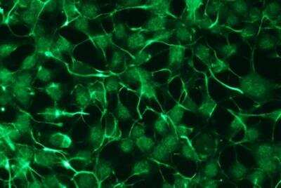 Immunocytochemistry/Immunofluorescence: PKC zeta Antibody (R14-K) [NBP1-30127] - Expression in HEK293 cells.