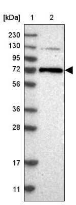 Western Blot: PKC zeta Antibody [NBP1-87270] - Lane 1: Marker  [kDa] 230, 130, 95, 72, 56, 36, 28, 17, 11.  Lane 2: Human cell line RT-431