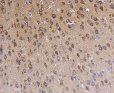 Immunohistochemistry-Paraffin: PKC zeta [p Thr560] Antibody (SN0753) [NBP2-67713] - Analysis of paraffin-embedded mouse brain tissue using anti-Phospho-PKC zeta(T560) antibody. Counter stained with hematoxylin.
