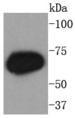 Western Blot: PKC zeta [p Thr560] Antibody (SN0753) [NBP2-67713] - Analysis of Phospho-PKC zeta(T560) on mouse eyeball lysates using anti-Phospho-PKC zeta(T560) antibody at 1/1,000 dilution.